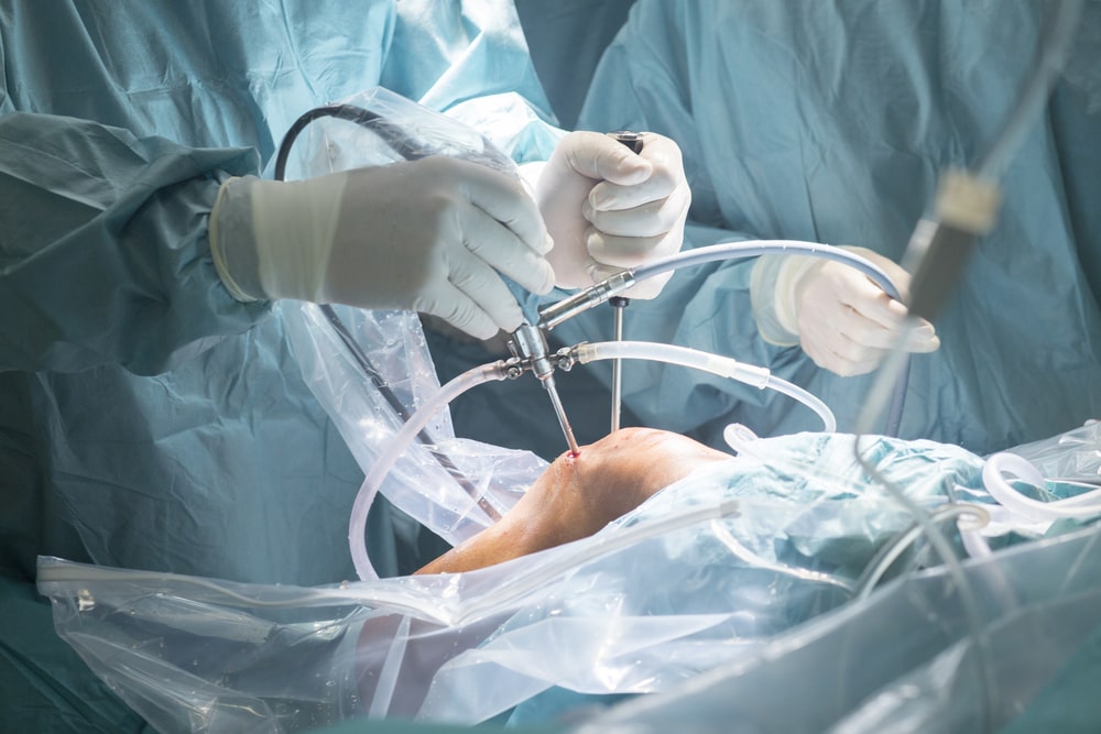 Orthopedic Surgical Instruments